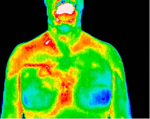 1% of breast cancers are in men