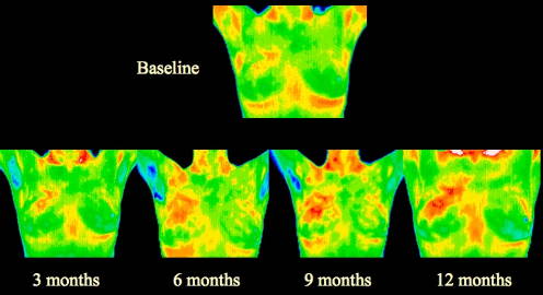 progression.014-cropped