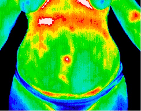 Right kidney infection